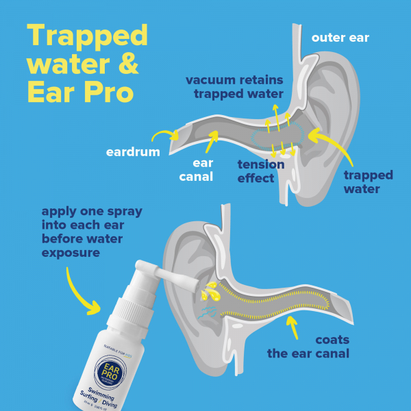 Ear Pro Spray de protection des oreilles pour les sports aquatiques